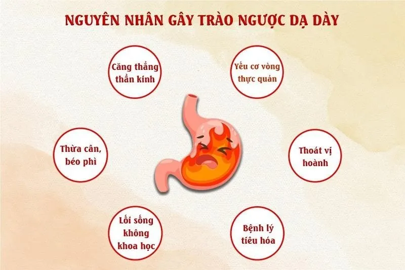 Nguyên Nhân Gây Trào Ngược Dạ Dày