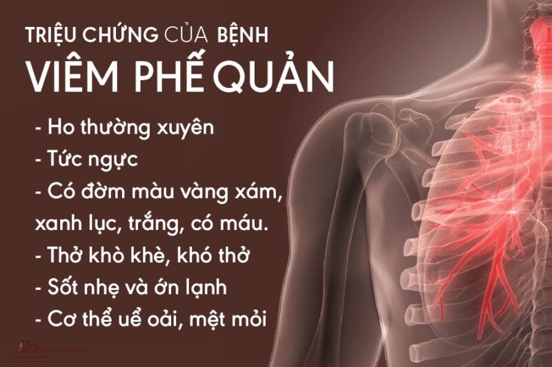 Nguyên Nhân Dây Viêm Phế Quản