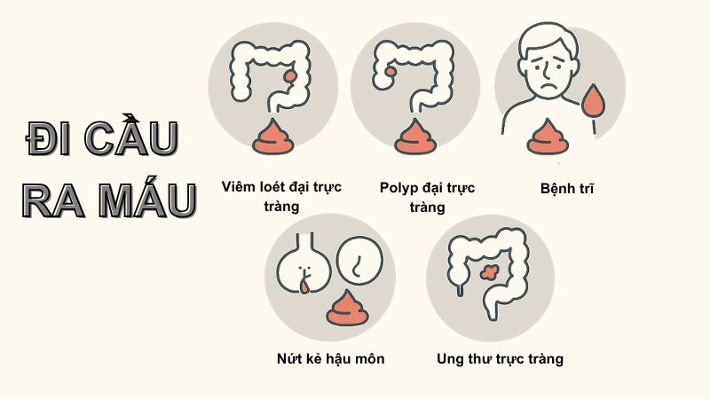 Nguyên nhân thường gặp