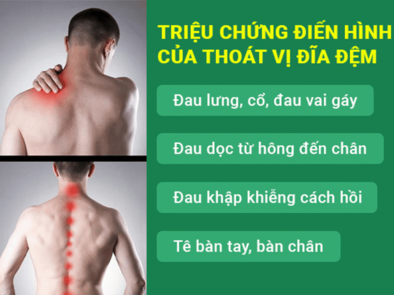 Dấu Hiệu Nhận Biết Thoát Vị Đĩa Đệm
