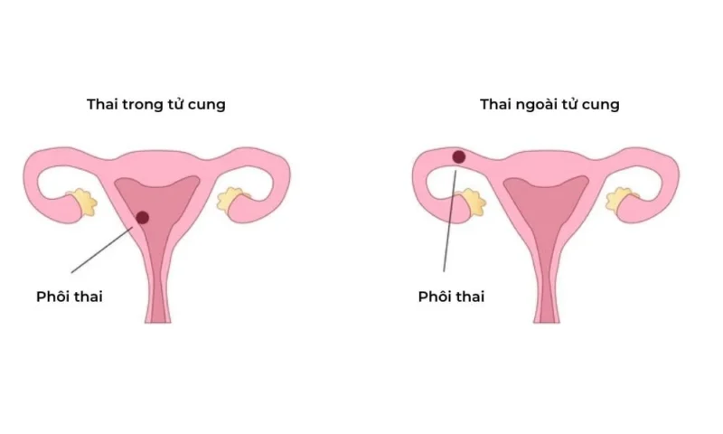 Cơ chế hoạt động của thuốc Pha Thái