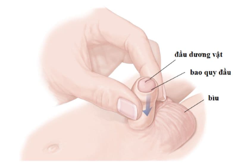 Lợi Ích Của Việc Cắt Bảo Quý Đầu