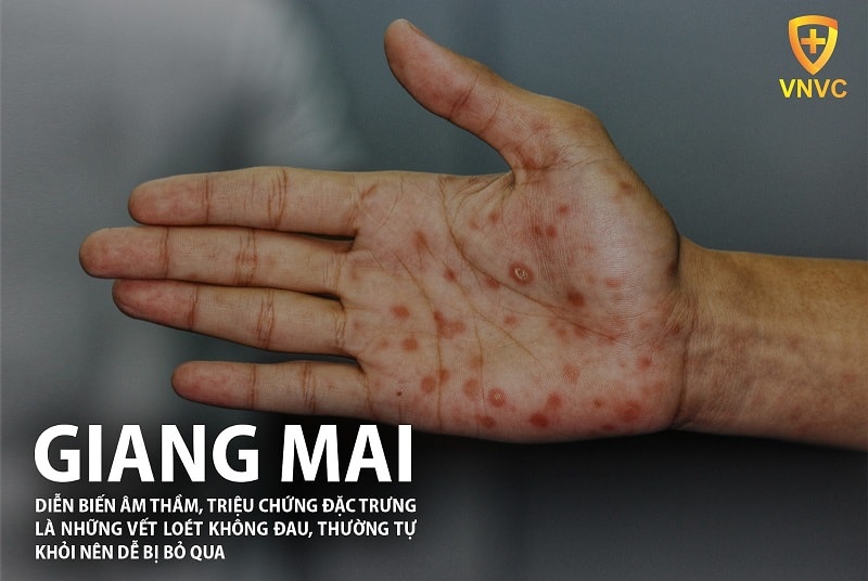 Giang Mai Có Nguy hiểm Không?