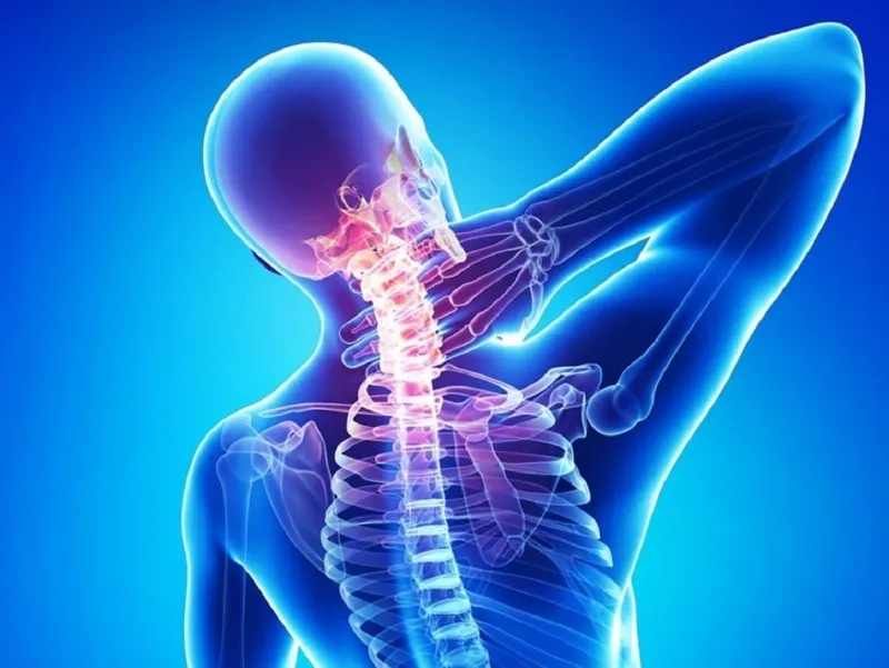 nguyên nhân gây hủy hoại đốt sống cổ