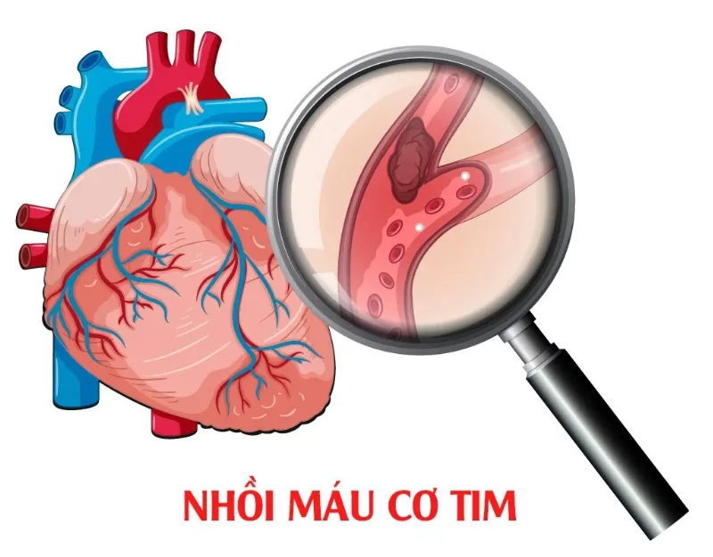 cơ cơ tạo máu là gì và trò chơi của cơ tim