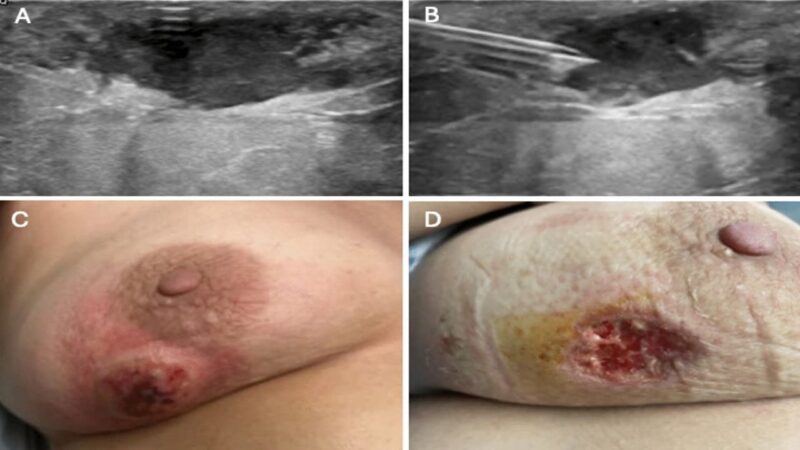 Các loại ứng dụng thường gặp