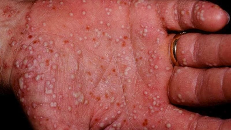 Chứng chỉ của mẫu