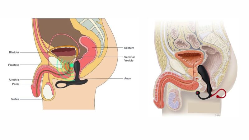 Tuyến tiền liệt kê là gì và ở đâu trong cơ thể?
