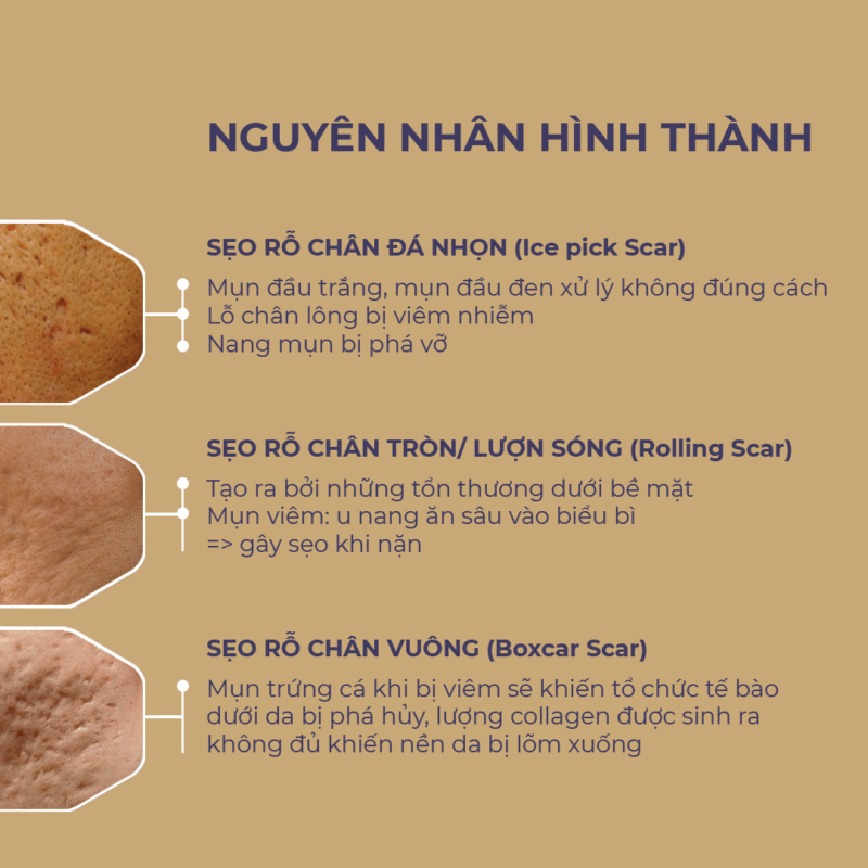 Nguyên nhân hình thành sừng