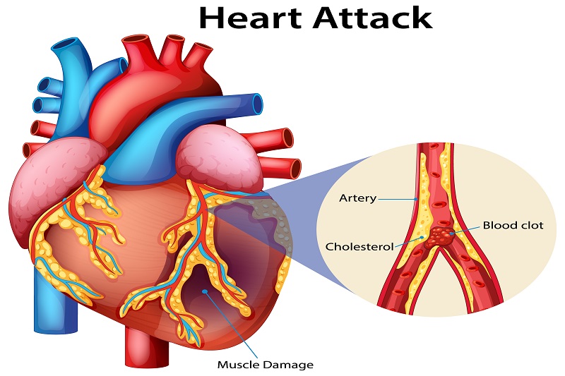cơ chế thành cơ chế bổ sung máu