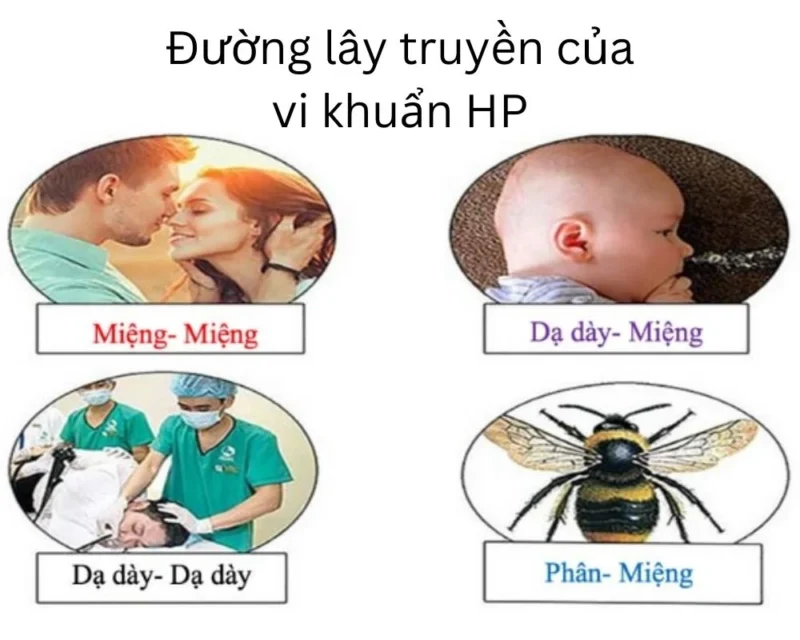Con đường lây nhiễm vi khuẩn HP