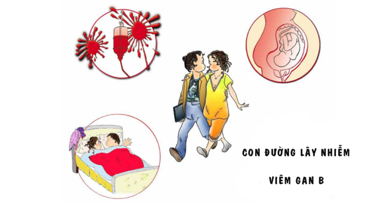 nguyên nhân và bệnh viêm lan viêm gan B