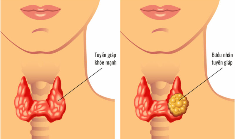 Xông khói là gì?