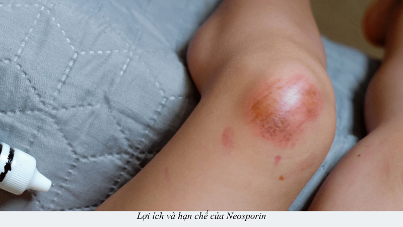 neosporin