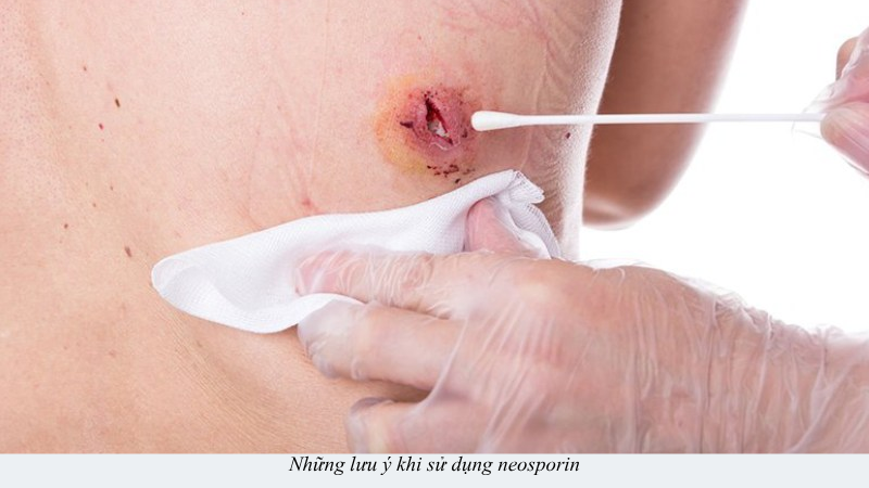 neosporin