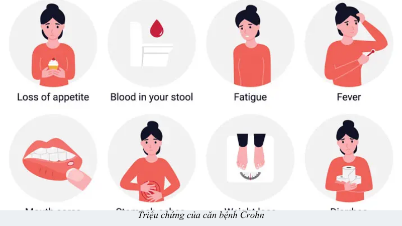 bệnh crohn