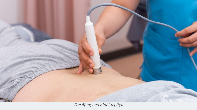 nhiệt trị liệu
