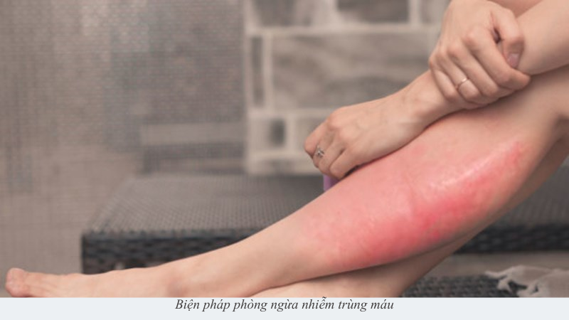 nhiễm trùng máu