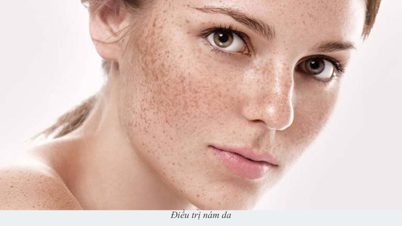 trị nám