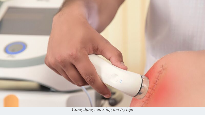 sóng âm trị liệu