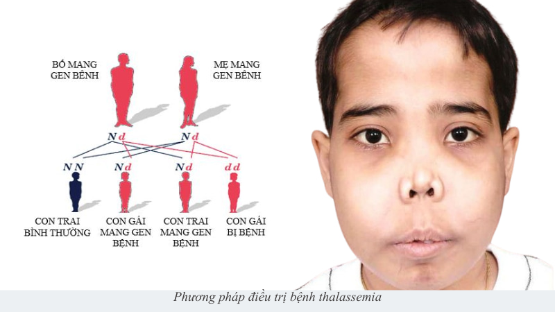 bệnh thalassemia