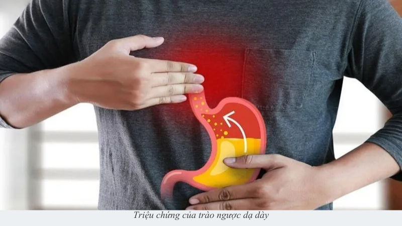 trào ngược dạ dày