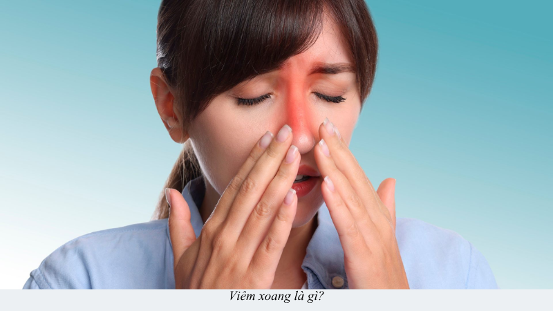 viêm xoang