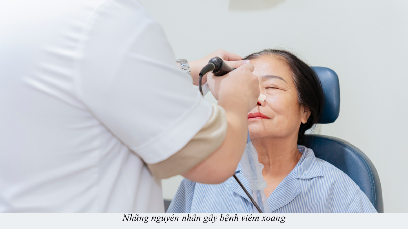 viêm xoang