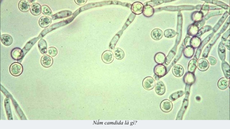 nấm candida