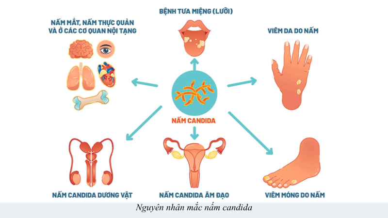 nấm candida