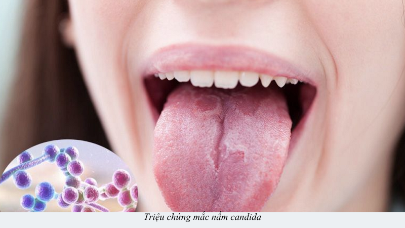 nấm candida
