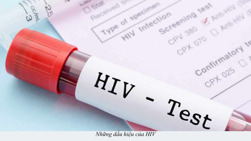 dấu hiệu HIV