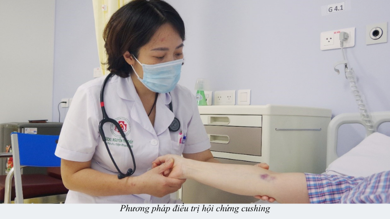 hội chứng cushing