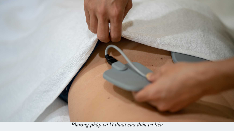 điện trị liệu