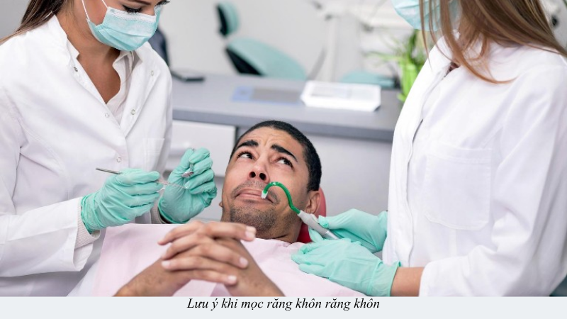 mọc răng khôn