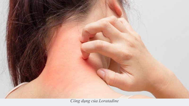 Loratadine