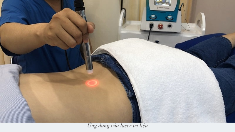 Laser trị liệu