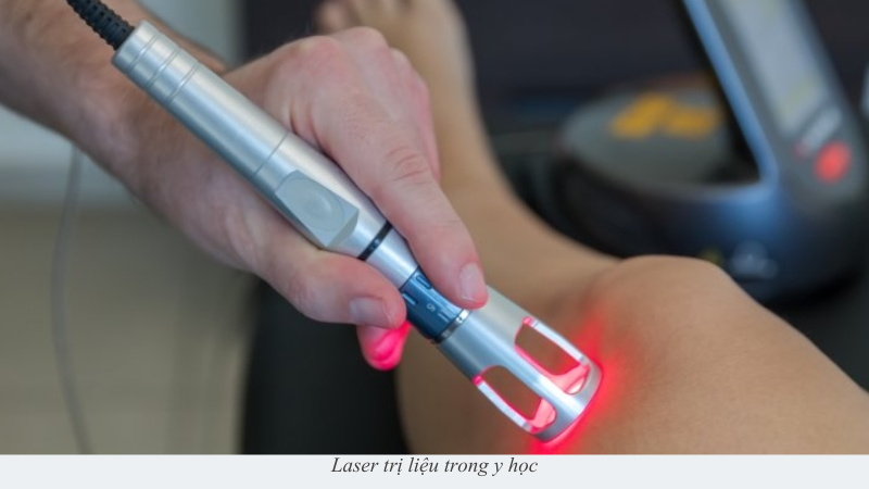 Laser trị liệu