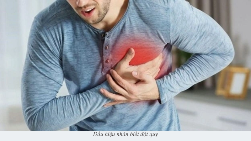 Đột quỵ