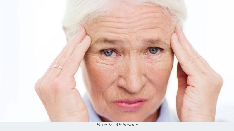 Alzheimer