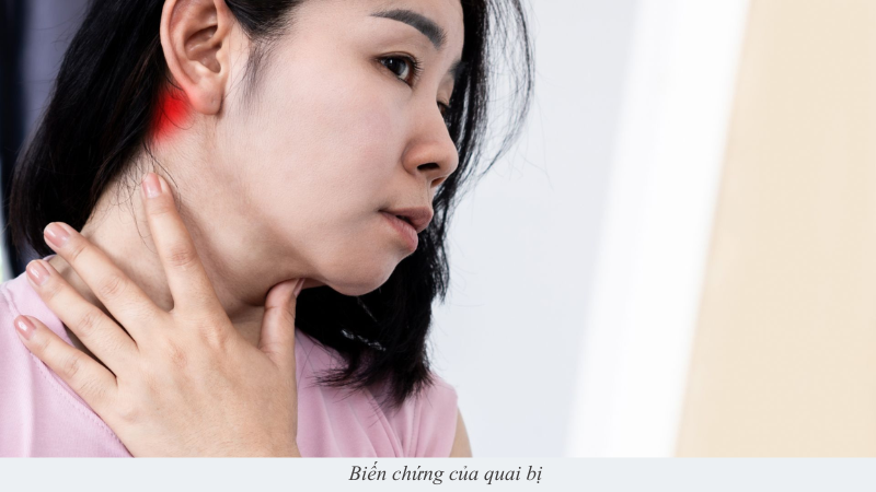 Quai bị