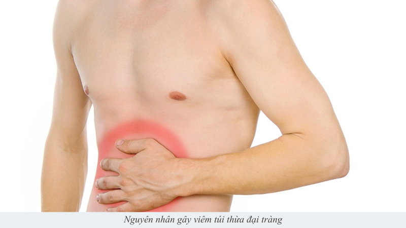 Viêm túi thừa đại tràng